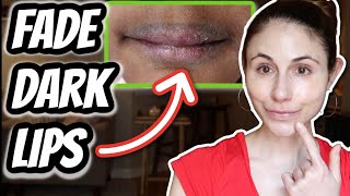 HOW TO FADE DARK LIPS  Dr Dray [upl. by Publias297]