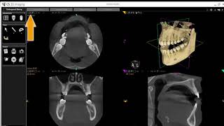 CS 3D imaging software basic tutorial Carestream [upl. by Riorsson431]