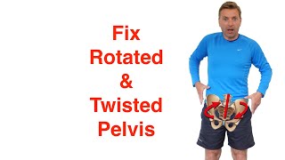 Best Rotated Pelvis Correction Exercises [upl. by Stargell984]