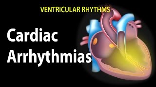 Cardiac Arrhythmias Animation [upl. by Donovan]