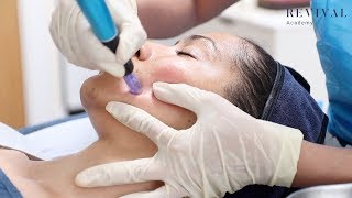 Microneedling Full Training Video [upl. by Fenwick]