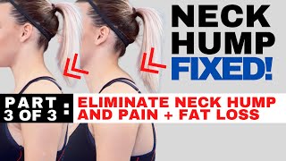 How to ELIMINATE a Neck Hump and Neck Fat [upl. by Rivi]