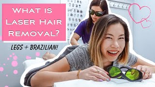 My Laser Hair Removal Experience  Legs amp Brazilian [upl. by Maillw]