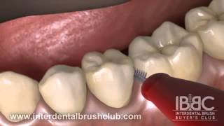 HOW TO USE AN INTERDENTAL BRUSH [upl. by Clausen169]