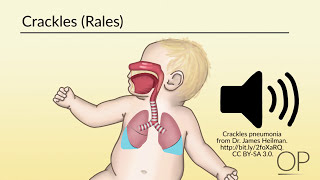 Respiratory Assessment by B Leary L DelSignore  OPENPediatrics [upl. by Harald305]