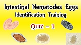 Intestinal Nematodes Eggs Identification Training Quiz 14 [upl. by Iong]