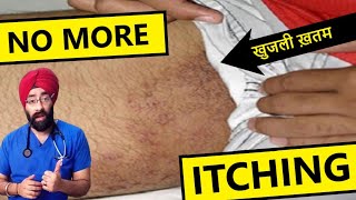 How to cure itching in private part  fungal infection  daad khaj khujli ka ilaj  DrEducation [upl. by Aihsenot]