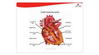 Dysrhythmia Management [upl. by Leirda]