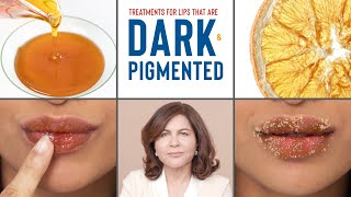 How To Treat DARK PIGMENTED Lips  Dermatologists Advice [upl. by Yllut]