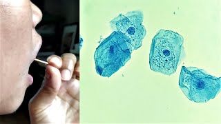 Cheek Epithelial Cell Practical Experiment [upl. by Orravan]