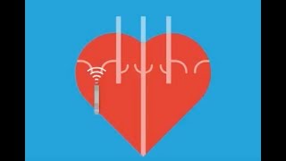 Atrial Rhythms  EKG Interpretation  LevelUpRN [upl. by Knute]