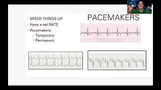 EKG Treating Dysrhythmias [upl. by Joselow]