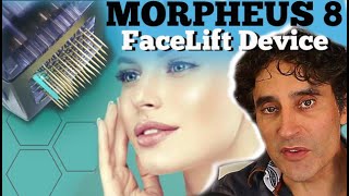 MORPHEUS 8  Non Surgical Facelift [upl. by Laram]