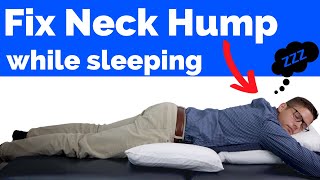 How to Fix Neck Hump While Sleeping [upl. by Bergquist]