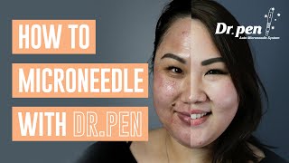 How to microneedle at home with Dr Pen  Dr Pen Australia  Microneedling  Skin Needling  CIT [upl. by Yseult]