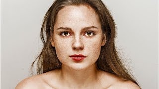 How to Grow Freckles Naturally and Safely [upl. by Anialam]