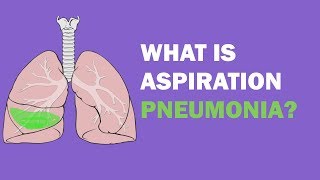 What is aspiration pneumonia [upl. by Anohr]