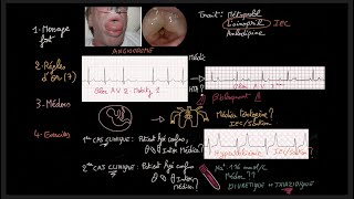 Traitement de lhypertension artérielle  Guidelines  Exercices  HTA  Docteur Synapse [upl. by Steddman486]