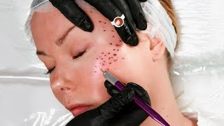 Tattooing my FACE😱 Realistic faux freckles😍 [upl. by Zhang418]